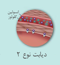 دیابت غیروابسته به انسولین (نوع 2)